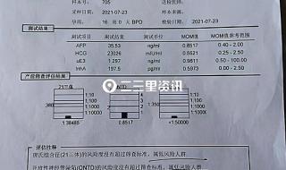 在广州京溪南方医院做全面的产检大概要多少钱呢 医院产检多少钱